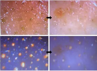 ポアレスサロンfil 中山のエステ・リラクイメージ