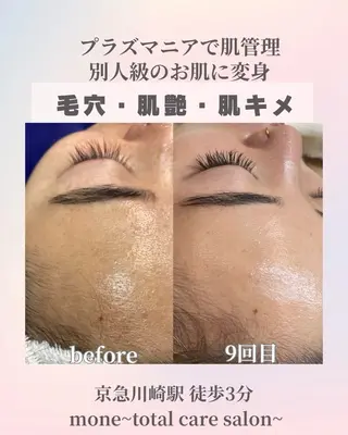 mone~total care salon~所属・mone (モーネ)のエステ・リラクイメージ