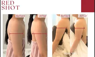 Lala Beautyのエステ・リラクイメージ