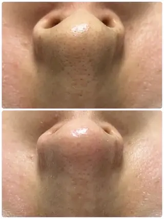 TLIENGLE高宮 エステ・ネイルのエステ・リラクイメージ