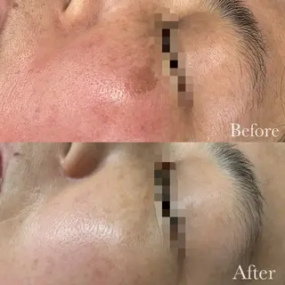 美容鍼脱毛salon リノン吹田駅前店のエステ・リラクイメージ