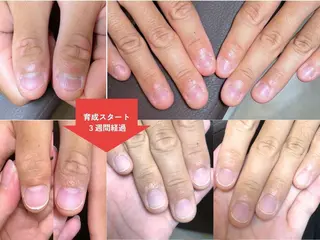 ネイル 深爪矯正・自爪育成 ネイルサロンアモまいのネイルデザイン