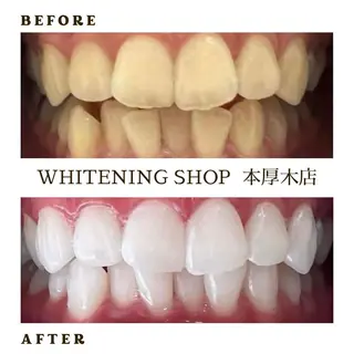 メンズ ホワイトニング ショップ本厚木のその他イメージ