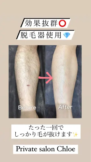 ミディアム カラー パーマ ヘアアレンジ メンズ キッズ ネイル マツエク・マツパ アイブロウ Chloe-クロエ- 脱毛/フェイシャルのエステ・リラクイメージ