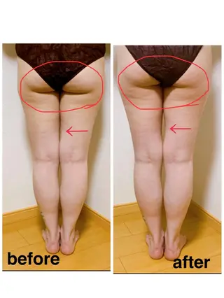 痩身/脱毛/ネイル HARUKAのエステ・リラクイメージ