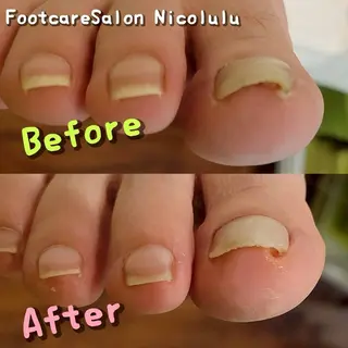 足トラブル専門 ニコルル金沢のエステ・リラクイメージ