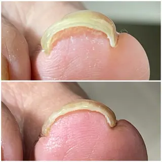 ネイル 深爪育成専門nail _Lumièlatのネイルデザイン
