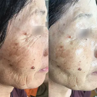 🏳️‍🌈 CHIYAKAのエステ・リラクイメージ