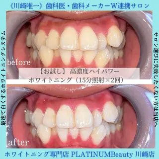 PLATINUM Beauty 川崎店のエステ・リラクイメージ