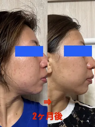 メナード東銀座所属・Fukunaka Mikaのエステ・リラクイメージ