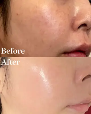 グリーンピール専門店 サロンY【大阪】のエステ・リラクイメージ