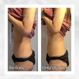 部分痩せ♥️小顔専門 MIKUのエステ・リラクイメージ