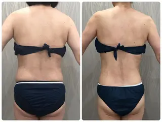 エステティックサロン ベルネのエステ・リラクイメージ