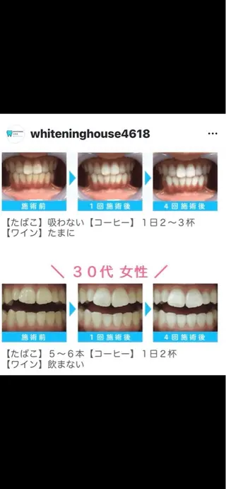 WHITENING ハウスのマツエク・マツパデザイン