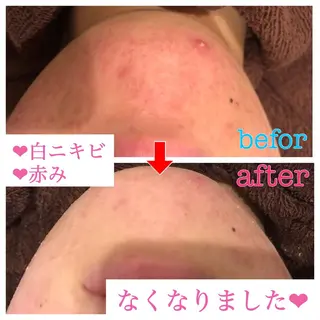 セミロング カラー パーマ ヘアアレンジ メンズ キッズ ネイル マツエク・マツパ 金の糸脱毛 産毛ケア専門のエステ・リラクイメージ