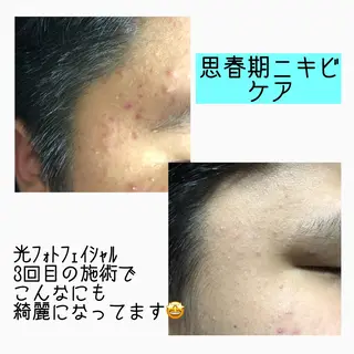 gratia ~ｸﾞﾚｲﾃｨｱ~のエステ・リラクイメージ