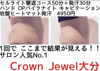Crown  Jewel所属・CrownJewel クラウン ジュエルのエステ・リラクイメージ