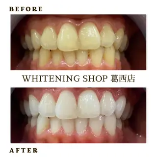 メンズ ホワイトニング ショップ葛西店のその他イメージ