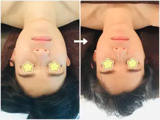 EXTR エクスターのエステ・リラクイメージ