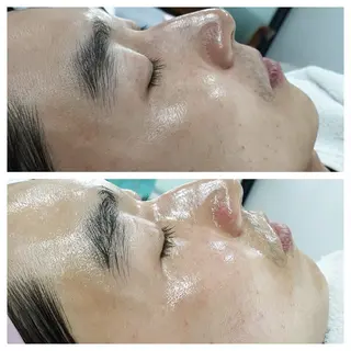 라라피（ララピ）所属・韓国式肌管理 ララピール専門のエステ・リラクイメージ