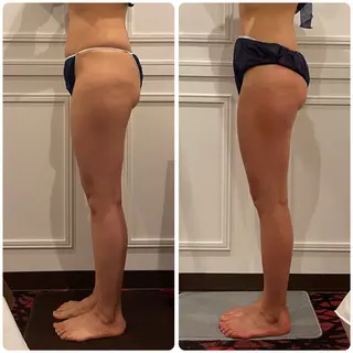 小顔×美肌デザイン✨ 理想へトータルケア◎のエステ・リラクイメージ