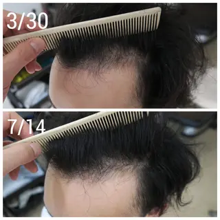 メンズ 薄毛ケア/痒みケア オガワシンペイのヘアスタイル