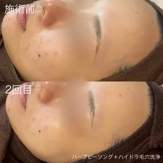lulula ricoのエステ・リラクイメージ