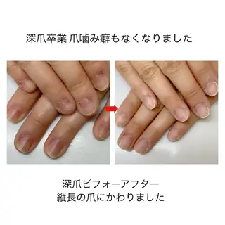 ネイル ネイルサロン アリュームのネイルデザイン