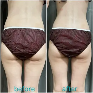 Loar エステ中野 絵里奈のエステ・リラクイメージ