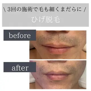 脱毛サロン Lokahiのエステ・リラクイメージ