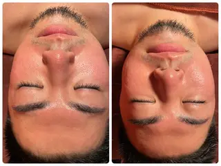 美肌，美ボディ，脱毛 サクラチャンスパのエステ・リラクイメージ