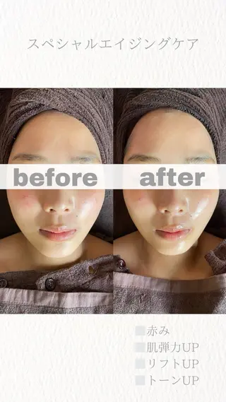 uru.所属・林田 圭純のエステ・リラクイメージ