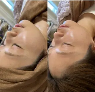 美容鍼灸サロン mahoroba院長のエステ・リラクイメージ