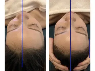 LUANA 美肌脱毛＋Skinのエステ・リラクイメージ