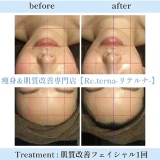 肌質改善専門店 Re.terna田辺のエステ・リラクイメージ