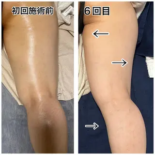 🌴Beauty Salon LANAのエステ・リラクイメージ