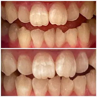 DIAMOND BEAUYのその他イメージ