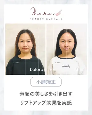 ikaru美容整体 池袋のエステ・リラクイメージ