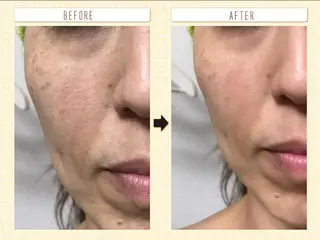 横浜ビューティーファクトリーHANA元町店所属・エステ＆アロマ HANAのエステ・リラクイメージ