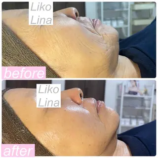 肌育脱毛サロン LikoLinaのその他イメージ