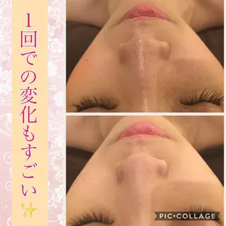 ミディアム カラー パーマ ヘアアレンジ メンズ キッズ ネイル マツエク・マツパ ニキビ・肌質改善専門 ♡人生が変わるサロンのエステ・リラクイメージ