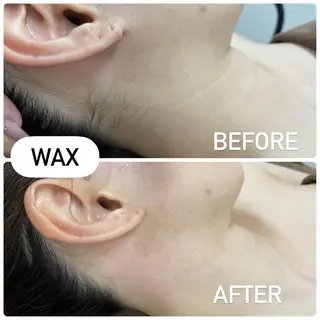 MIRUS所属・脱毛サロンMIRUS Yuukaのエステ・リラクイメージ