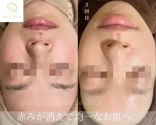 ハーブピーリング専門 グランディール　武内のエステ・リラクイメージ