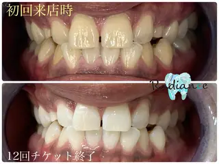 札幌ホワイトニング ラディアンス札幌駅店のその他イメージ