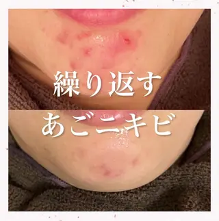 セミロング カラー パーマ ヘアアレンジ メンズ キッズ ネイル マツエク・マツパ アイブロウ ニキビ跡専門サロン Ainaのエステ・リラクイメージ