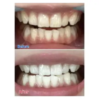 Ｍ渋谷 ホワイトニングのエステ・リラクイメージ