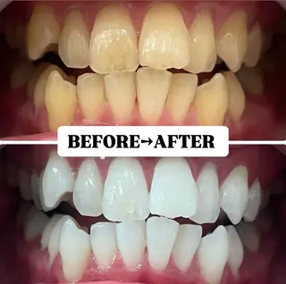 メンズ キッズ 歯科提携サロン ホワイトニング豊中のその他イメージ