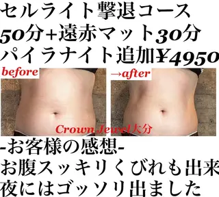 Crown  Jewel所属・CrownJewel クラウン ジュエルのエステ・リラクイメージ