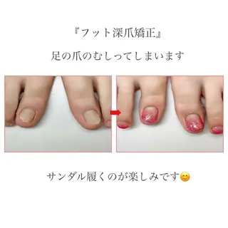ネイル ネイルサロン アリュームのネイルデザイン