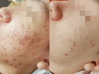 UI LANIのエステ・リラクイメージ